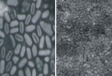 El objetivo de este descubrimiento a futuro es que se inicie un trabajo para desarrollar un bioinsecticida. Foto: Cortesía. larvas maíz cogollero plaga