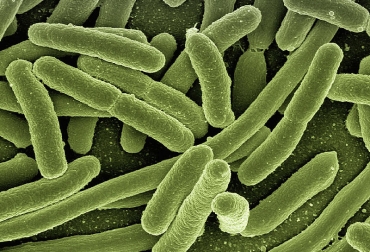 Aunque por lo general E.Coli se relaciona con infecciones del tracto digestivo, también se emplea en la industria farmacéutica o química. Foto: Creativ Commons. Ganadería, ganadería colombia, noticias ganaderas, noticias ganaderas colombia, CONtexto ganadero, E. Coli, catalizador biológico, Ingeniería Química de la Universidad Nacional sede Medellín, modelo que simula el crecimiento de E. coli a diferentes condiciones de temperatura, Metodología de Modelado Semifísico de Base Fenomenológica, bacterias, e.coli en humanos, microorganismo