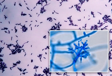 Dichos microbios mejoran la calidad del pasto y combaten la presencia de las garrapatas. Foto: omicrono.com / thunderhouse4-yuri.blogspot.com.co. microorganismos, microorganismos que aceleran la descomposición, Bacillus Subtilis, Trichoderma, uso del Bacillus Subtilis en ganadería, uso del Trichoderma en ganadería, ganadería racional voisin, ganadería sostenible, ganadería colombia, contexto ganadero