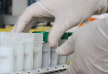Los cambios en el olor se deben principalmente a la desnaturalización de las grasas, llamado comúnmente enranciamiento. Foto: agrovoz.lavoz.com.ar Colombia, Leche, tipos de bacterias y las alteraciones que producen en la leche, Fedegán, Fondo Nacional del Ganado, Consejo Nacional de la Calidad de la leche y prevención de la Mastitis – CNLM, Fedegán Guía técnica para la obtención de leche de calidad, CONtexto ganadero, ganadería Colombia, Noticias ganaderas Colombia