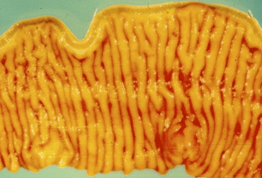 Las enfermedades entéricas provocan inflamación del intestino en los bovinos. Foto: biblioteca.uaa.mx Enfermedades entéricas ganado bovino Colombia, enteritis en bovinos, inflamación intestino bovino, afecciones entéricas terneros, enteritis en ganado, ganaderos Colombia, Contexto ganadero, noticias ganaderas Colombia