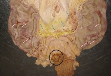 Esta es la presentación de una úlcera gástrica en equinos. Foto: scielo.org.ve Gastritis en equinos, úlceras gástricas en equinos, gastritis en caballos, gastritis en caballos de Colombia, nutrición caballos, nutrición equinos, alimentación caballos, manejo de equinos, alimentación caballos, contraindicaciones manejo caballos, recomendaciones caballos gastritis, CONtexto ganadero, ganaderos Colombia, noticias ganaderas Colombia