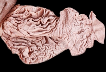 El abomaso, comportamiento también conocido como cuajar funciona como un estómago verdadero, en donde actúan enzimas para desdoblar las proteínas y absorber nutrientes. Foto: Anatomía Veterinaria (@anatovet) rumen vaca, estómagos vaca, abomaso en vaca, desplazamiento del abomaso en ganado, enfermedad digestiva en vacas, ganadería en colombia, ganado bovino, daños en rumen, obomaso, desplasamiento del obomaso, causas del desplazamiento del obomaso, contexto ganadero, noticias ganaderas, vacas