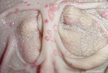 Este es uno de los tipos de estomatitis que afectan al ganado bovino. Foto: Patología Veterinaria Estomatitis papular bovina, Tipos de estomatitis en rumiantes, estomatitis en bovinos, estomatitis vesicular, tipos de estomatitis, Casos de estomatitis en Colombia, estomatitis Colombia, estomatitis New Jersey, estomatitis New Jersey Colombia, estomatitis bovinos, vacuna estomatitis Colombia, estomatitis, costos asociados a la estomatitis, casos estomatitis, Ganadería, Ganadería colombiana, noticias ganaderas, noticias ganaderas colombia, CONtexto ganadero