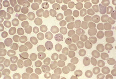 La babesiosis y la anaplasmosis son enfermedades que lo pueden confundir. Foto: Wikipedia ganadería, ganadería colombia, noticias ganadera colombia, contexto ganadero, lluvias, verano, parasitos, hemoparasitos, babesiosis, anaplasmosis, bovino, picazón, prencion, sangre, hemoglobina, propionato de imidocarb, ivermectina, células rojas, enfermedades, males, pasturas, ganaderos, ganaderos Colombia, secos, prados, pastos