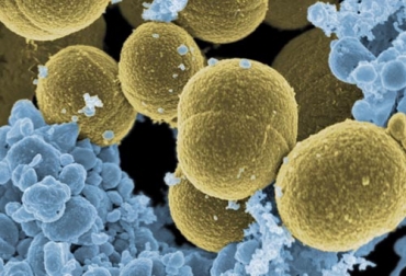 Una investigación en lecherías del Altiplano cundiboyacense encontró que el Staphylococcus aureus era el principal patógeno causante de mastitis. Foto: es.wikipedia.org mastitis bovina, mastitis clínica bovina, mastitis Staphylococcus aureus, agentes mastitis Colombia, Colombia Staphylococcus aureus bovinos, Colombia mastitis Staphylococcus aureus, causas mastitis, ordeño manual adecuado, buenas prácticas de ordeño, CONtexto ganadero, ganaderos colombia, noticias ganaderas colombia