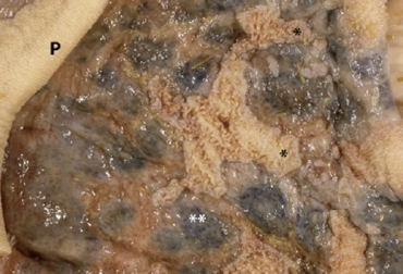 Este proceso inflamatorio de la capa epitelial del rumen está asociado a la acidosis ruminal. Foto: researchgate.net Rumenitis, rumenitis en bovinos, inflamación del rumen en bovinos, causas rumenitis, etología rumenitis, Acidosis metabólica en bovinos, síntomas acidosis metabólica en bovinos, tratamiento acidosis metabólica en bovinos, causas acidosis metabólica en bovinos, acidosis ruminal, acidosis metabólica, CONtexto ganadero, ganaderos colombia, noticias ganaderas colombia