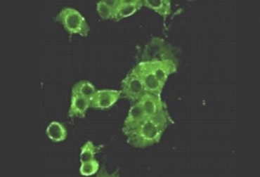 Esta es una imagen del coronavirus bovino, que ocasiona principalmente diarreas en terneros. Foto: euroveterinaria.com Coronavirus 2020, últimos datos coronavirus, covid19, covid 19, coronavirus china, coronavirus Colombia, coronavirus China 2020, Coronavirus humano, Coronavirus bovino, Virus en bovinos enfermedades de los bovinos, Enfermedades de los rumiantes, Coronarivus bovino Colombia, Tratamiento para el coronavirus bovino, Corovinarus, CONtexto ganadero, ganaderos colombia, noticias ganaderas colombia