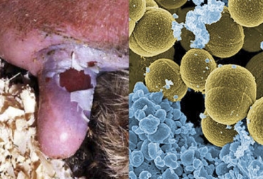 Las bacterias pueden adquirir resistencia a antibacterianos de dos formas: natural o intrínseca, o adquirida. Foto: produccion-animal.com.ar - es.wikipedia.org Transmisión resistencia, resistencia bacterias, antiparasitarios, antibióticos, resistencia antiparasitarios, resistencia antibióticos, causa resistencia parasitos, medicamentos, control de plagas, infecciones bovinas, ganaderos, coronavirus, coronavirus Colombia, COVID-19, cuarentena, Ganadería, ganadería colombia, noticias ganaderas, noticias ganaderas colombia, CONtexto ganadero