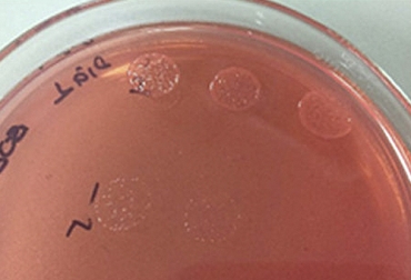El adecuado desempeño de las bacterias solubilizadoras de fosfato, está influenciado por factores tales como el pH, la salinidad y la temperatura. Foto: lanoticiasinfronteras.com fósforo, bacterias, suelos, solubilizadoras, fertilizantes, fosfatos, salinidad, temperatura, Forrajes, pasturas, raigrás, trébol rojo, biomasa, Ganadería, ganadería colombia, noticias ganaderas colombia, CONtexto ganadero