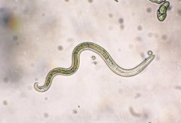 Hay diversas varidades de parásitos gastrointestinales, como los helmintos, que afectan a los rumiantes. Foto: parasitos.info tipos de helmintos, helmintos rumiantes, helmintos ganadería, enfermedades causadas por los helmintos, helmintos, control helmintos, control parásitos, parásitos bovinos, control estrategico parásitos, control quimico parásitos, control no quimico parásitos, ganaderos, ganaderos colombia, ganado, bovinos, ganado bovino, Ganadería, ganadería colombia, noticias ganaderas, noticias ganaderas colombia, CONtexto ganadero, contextoganadero