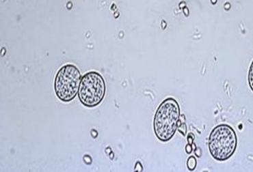 En Colombia se ha realizado estudios sobre la prevalencia de la coccidiosis en bovinos y el ICA realiza vigilancia en algunas zonas del país, haciendo inspección a predios. Foto: redmidia.com Coccidiosis en bovinos, coccidiosis bovina, Enfermedad ganado, deshidratación animal, pérdida de apetito animal, heces con sangre en ganado, coccidiosis, enfermedad infecciosa, Parásitos en bovinos, enfermedades, muerte reses, reses Colombia, coccidiosis bovina en Colombia, ganado bovino, ganadería bovina, ganaderos, ganaderos colombia, ganado, vacas, vacas Colombia, bovinos, Ganadería, ganadería colombia, noticias ganaderas, noticias ganaderas colombia, CONtexto ganadero, contextoganadero