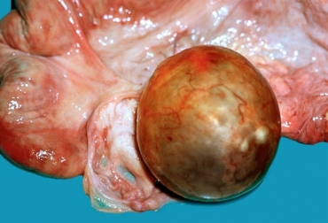 Los quistes ováricos en vacas es una de las causas más frecuentes de problemas reproductivos, dependiendo de su clasificación. Foto: tomastruccomedvet.blogspot.co Quistes ováricos en vacas