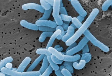 Un estudio en Ecuador encontró que 8 cepas de Lactobacillus tienen potencial probiótico para prevenir infecciones en el tracto reproductivo en vacas. Foto: biotechmagazineandnews.com probiotico lactobacilo para combatir infecciones en vacas