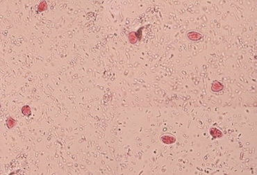 Cryptosporidiosis y giardiosis se presenta en los dos primeros meses de los bovinos y pueden ser mortales. Foto: blogsanidadanimal.com Cryptosporidiosis y giardiosis en bovinos
