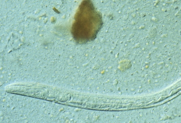 La estrongiloidiasis es producida por los gusanos redondos (nematodos) Strongyloides que parasitan el sistema digestivo del ganado, caballos y mascotas. Foto: es.wikipedia.org estrongiloidiasis animales