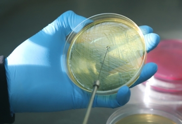 El desarrollo de la vacuna contra Escheriachia coli en bovinos es un paso importante para la humanidad porque es una bacteria que llega a los humanos. Foto: intainforma.inta.gob.ar Vacuna contra Escheriachia coli en bovinos
