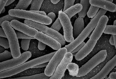 El biosensor fue creado por la empresa española Biomética. Foto: Wikipedia. bacteria E. coli
